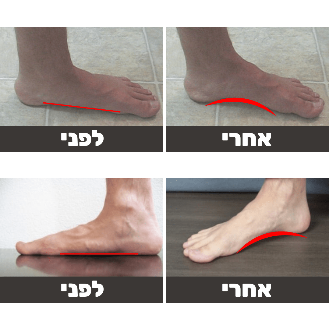 רפידות לנעל | להעביר יום בלי כאבים | מבצע חיסול מלאי | מבית פומי ספורט - Pomy Sport