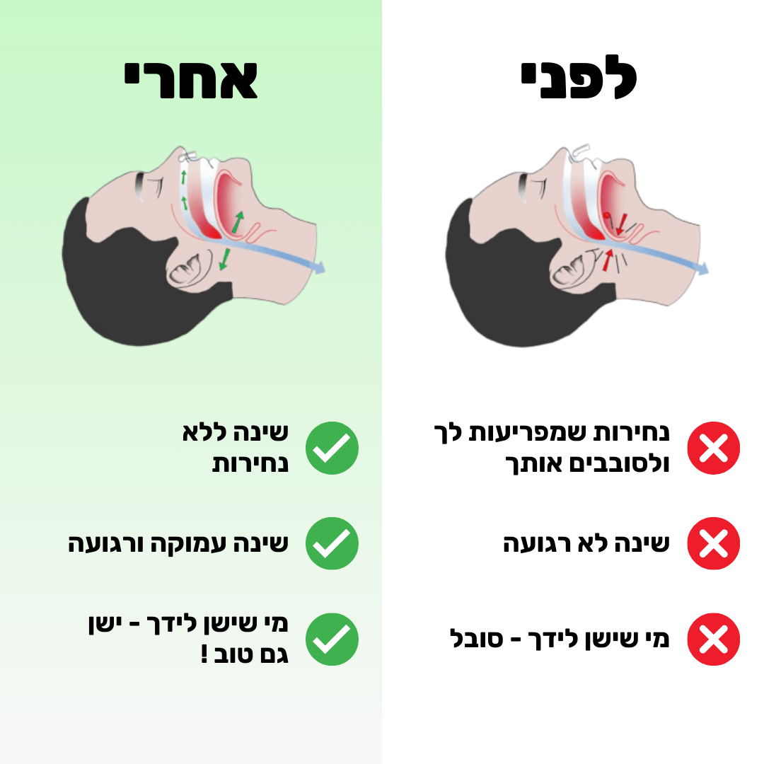 רצועת שינה למניעת / הקלת נחירות ודום נשימה | מבית פומי ספורט | מבצע חיסול - Pomy Sport