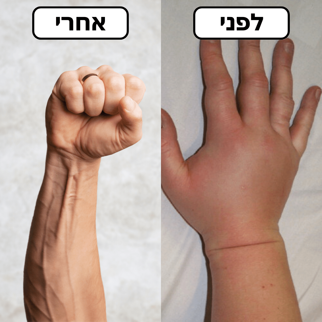 כפפות לשיכוך כאבי ידיים ומפרקים | הקלה מיידית - Pomy Sport