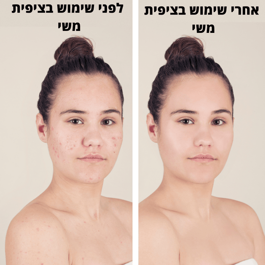 ציפית אנטי - חיידקים לבריאות העור והשיער | שינה איכותית ובריאה יותר - Pomy Sport