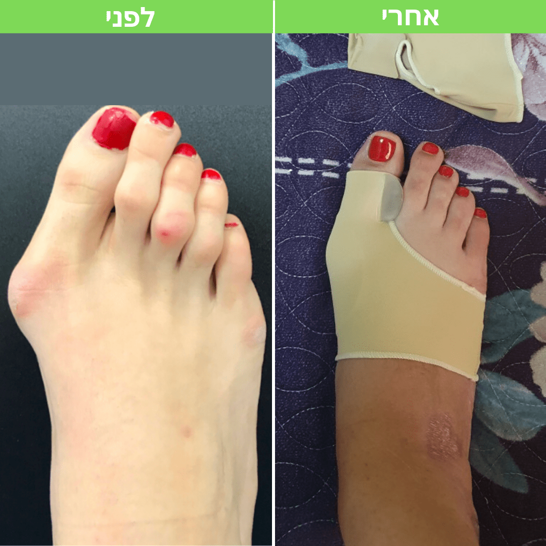 גרב הפלא לבוהן ולעצם הבולטת | מבית פומי ספורט - Pomy Sport