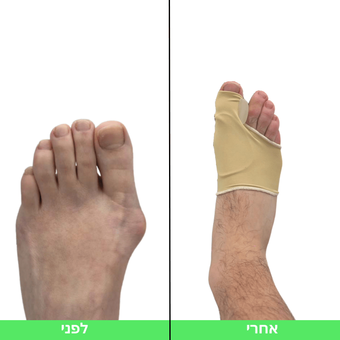 גרב הפלא לבוהן ולעצם הבולטת | מבית פומי ספורט - Pomy Sport