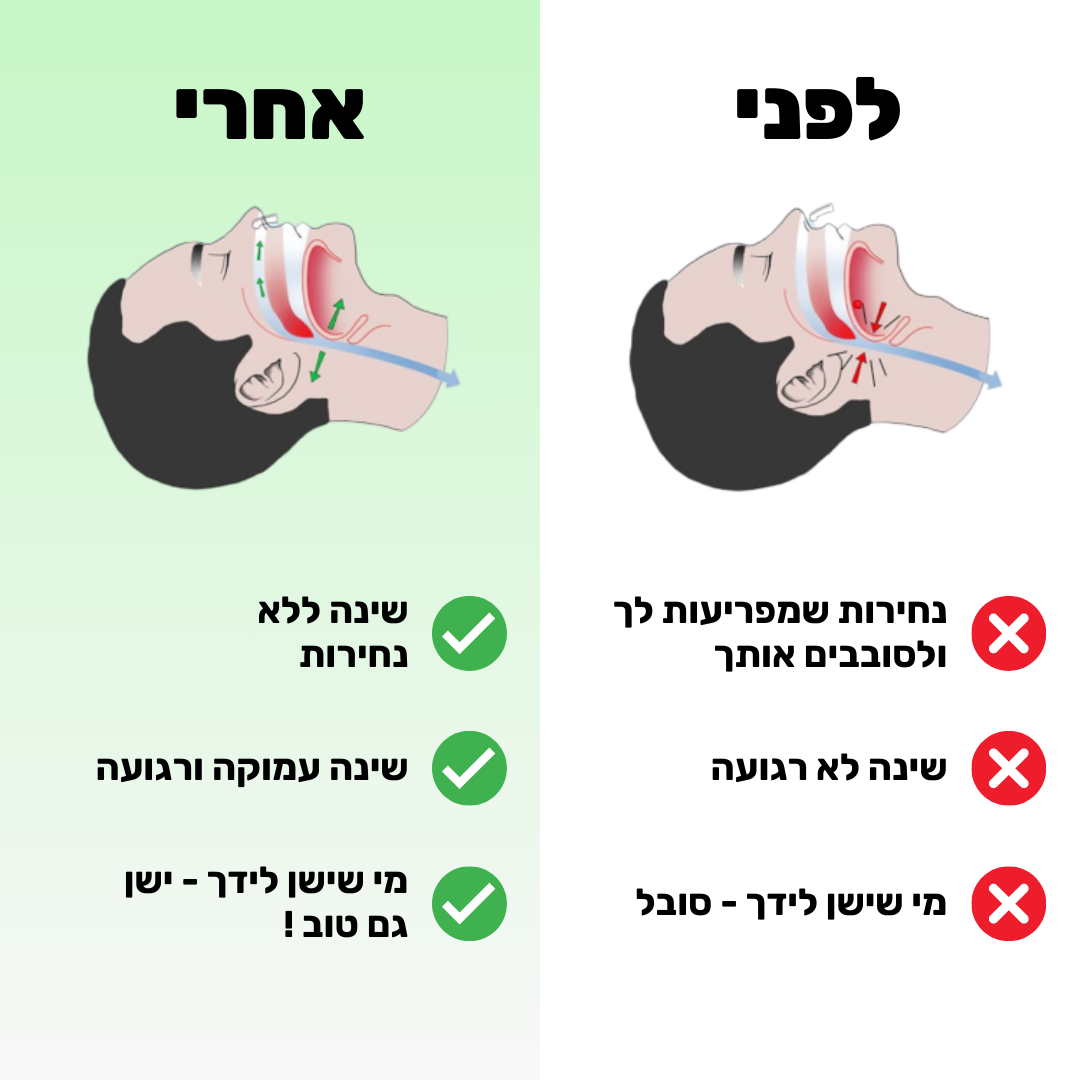 רצועת שינה למניעת / הקלת נחירות ודום נשימה | מבית פומי ספורט